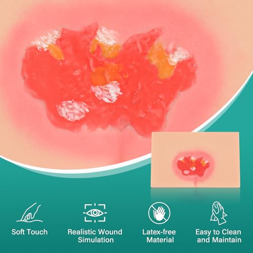 Image of Decubitus Ulcer Wound Care Model, Bedsores Model
