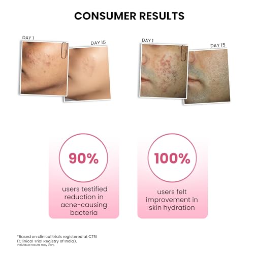Image of ThriveCo Goodbye Acne️ Kit | Serum (10ml) & Face Wash (25ml) | Reduces Acne, Acne Marks & Sebum | With Diacnemide, Azelaic Acid, Witch Hazel & Niacinamide | Nondrying & Moisturising | Travel-Friendly