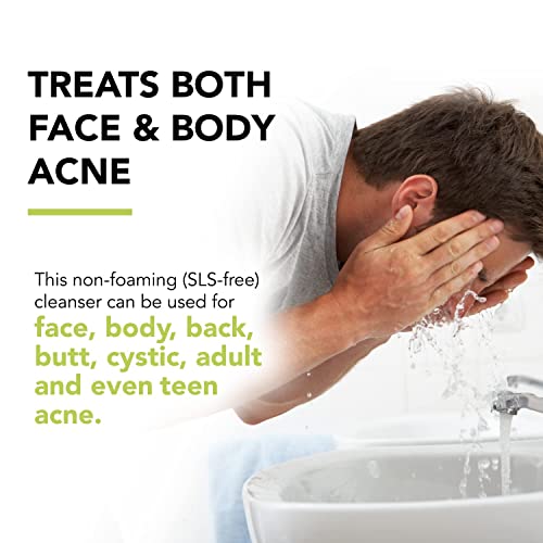 Humane Maximum-Strength Acne Wash - 10% Benzoyl Peroxide Acne Treatment For Face, Skin, Butt, Back And Body - 16 Fl Oz - Dermatologist-Tested Non-Foaming Cleanser - Vegan, Cruelty-Free #TOP4