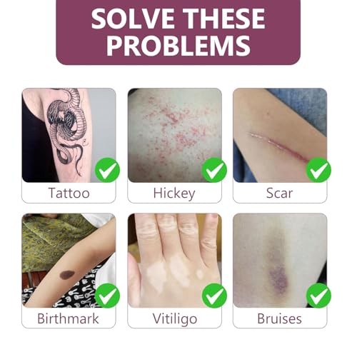 Tattoo Cover Up Patch, Invisible Tattoo Cover Up Makeup Waterproof and Sweatproof, Ultra Thin T-attoo C-over Up Tape for T-attoos,Scars & Spots