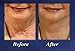 Bring It Up Instant Neck Lift Tape 30 Day Supply, Transparent Neck Lifting Anti Wrinkle Stickers - Tones Sagging Necklines Instantly - Made in USA