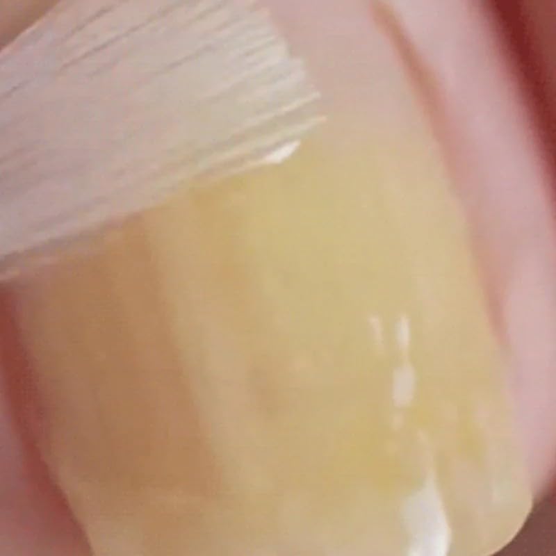 Miniatura 6 de Solución natural de reparación de uñas suave y eficaz, reparación de uñas multiusos, solución de uñas para uñas descoloridas y dañadas, mejora