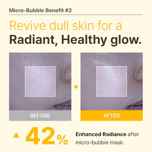 MENOKIN-30-Seconds-Quick-Bubble-Mask-BRIGHT-Vitamin-C-Glutathione-Niacinamide-in-Micro-bubbles-for-Dark-Spots-Uneven-Skin-Tone-Korean-Skin-Care-Essential-70-Uses-321-floz