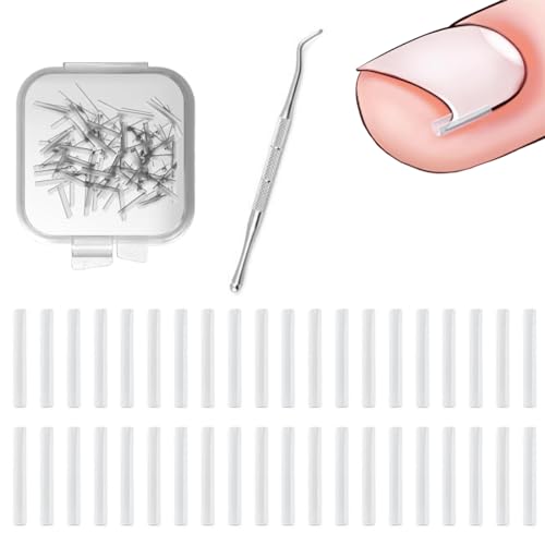 WeddHuis 41 Pcs Corrección de Uñas Encarnadas Set Correctoras de Uñas Encarnadas con Levantador de Uñas Kit de Corrección de Uñas los Pies de Plástico para Cuidado del Pie en Mujeres Hombres