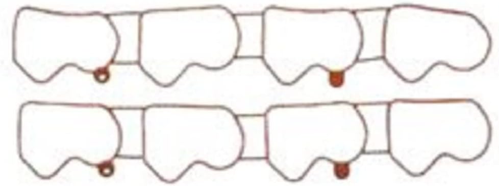 MAHLE MS16287 Engine Intake Manifold Gasket Set