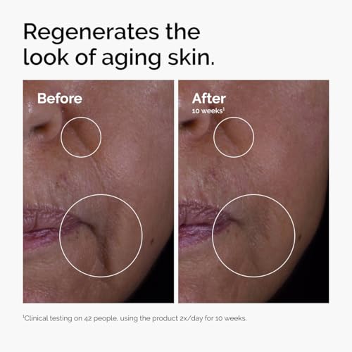 Image of The Ordinary GF 15% Solution, Anti-Aging Formula for Visible Skin & Wrinkle Repair