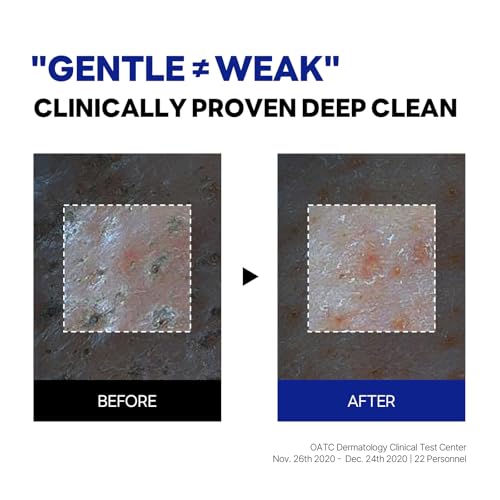 ROUND LAB Birch Juice Moisturizing Cleanser | Unclogs hidden sebum, Clears away dead skin cells., Soothing, Low pH, Gel Type Cleanser (5.07 fl.oz) - Image 8