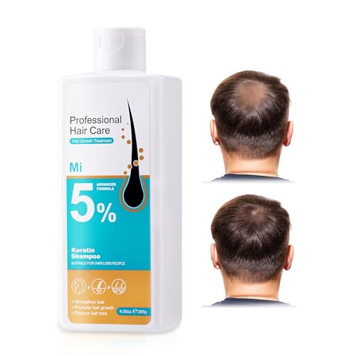 Champú para el crecimiento del cabello, Champu Anti Caída del Cabello, Champú para Engrosar Pelo, Apoya el Crecimiento Pelo Hombres y Mujeres, Prevención de la pérdida Hair