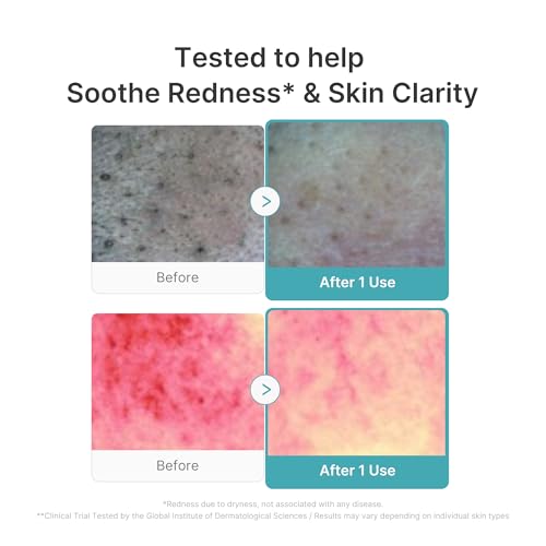 Image of medicube Facial Cleanser Azelaic Acid Capsule Foam Cleanser | Soothing Daily Cleansing Foam For Troubled Skin & Excess Sebum Control | Uneven Skin with Niacinamide, Glycerin | Korean Skincare, 4.23 oz