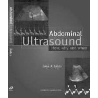 Abdominal Ultrasound