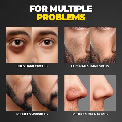 Image of Beardo Ultra Glow Brightening Face Serum for Men | Powered by 15% Niacinamide, Vitamin C, Glutathione | Simple Serum for Men | Brightening Face Serum - 10ml