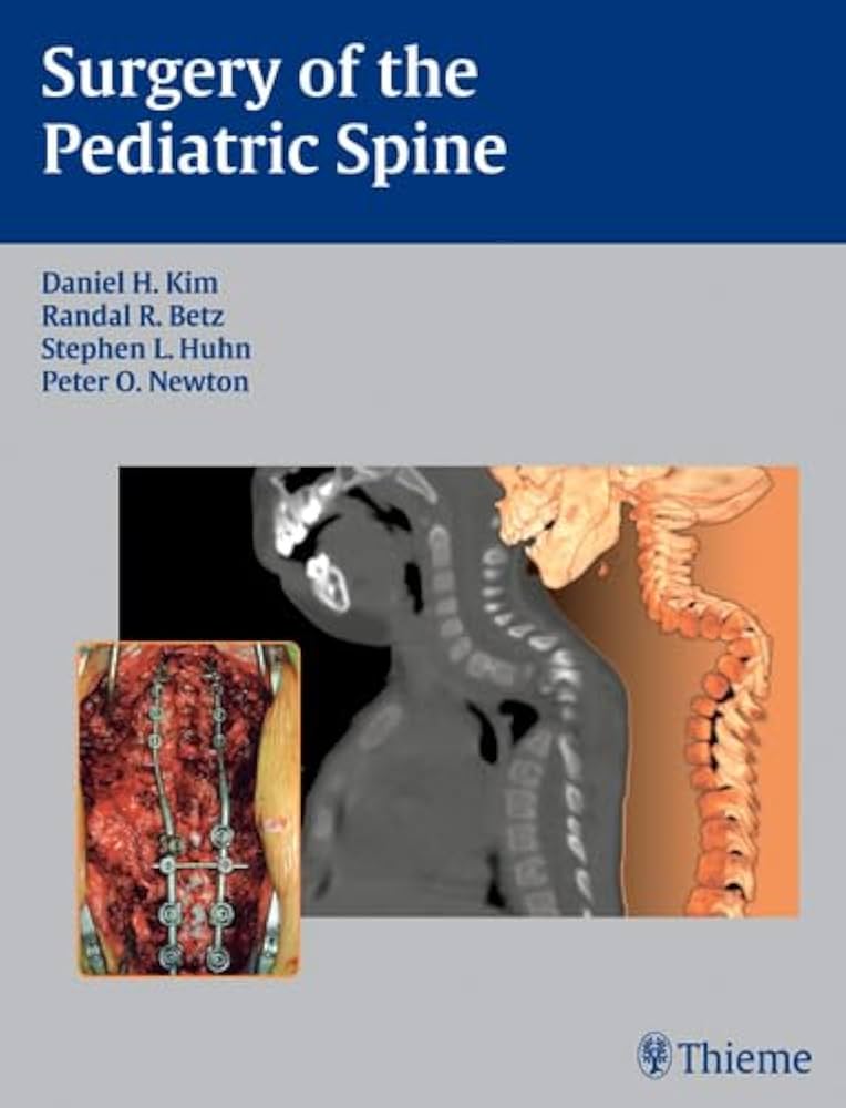 Surgery of the Pediatric Spine: 9781588903426: Medicine