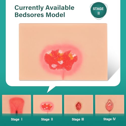 Image of Decubitus Ulcer Wound Care Model, Bedsores Model