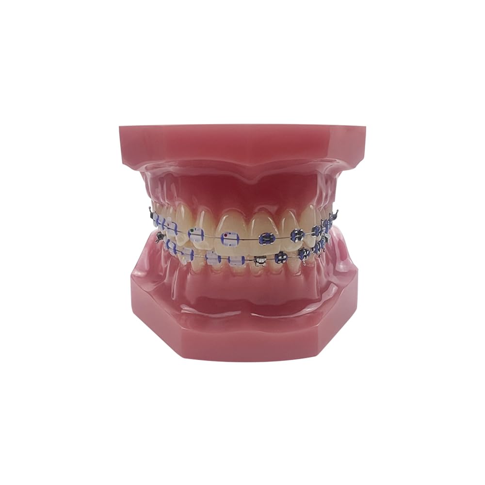 Orthodontisches Zahnmodell mit Halterungen, YOUYA DENTAL Demonstration Orthodontisches Modell für Bildung, Zähne Demonstration Typodonte Anatomisches Lehrwerkzeug mit Metall und Keramischer Halterung