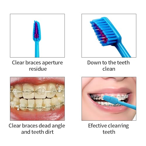 Image of Boxed Portable Orthodontic Care Kit Orthodontic Toothbrush Kit for Braces for Orthodontic Patient Travel Oral Care Kit Dental Travel Kit Interdental Brush Dental Wax Dental Floss (8 Pcs /Pack)-Blue