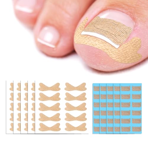Ingrown Toenail Treatment Patches: 2 Types of 110Pcs Breathable Ingrown Toenail Corrector Strips, Professional In Grown Toe Nail Treatment Patch for Toenail Growth Angle Correction and Pain Relief
