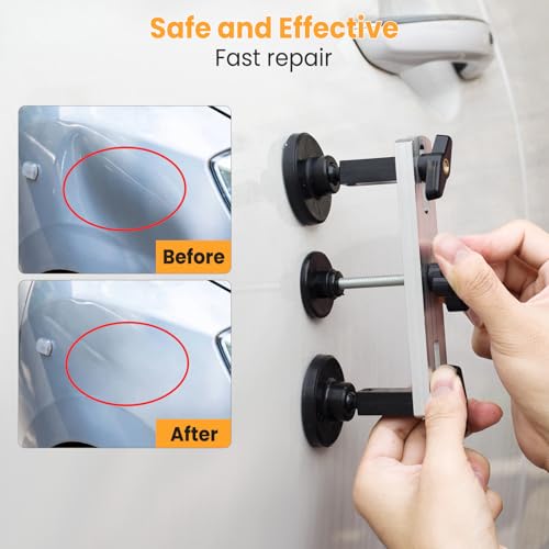 Sigoobal Car Dent Puller Kit
