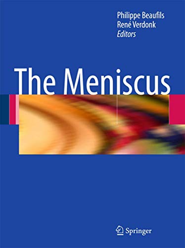 The Meniscus view 2