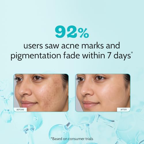 Image of Chemist At Play 10% Niacinamide Face Serum | For Acne Marks, Dark Spots & Open Pores | Improves Skin Texture, Controls Oil & Minimizes Pores | Lightweight Serum For Men & Women | All Skin Types | 10ml