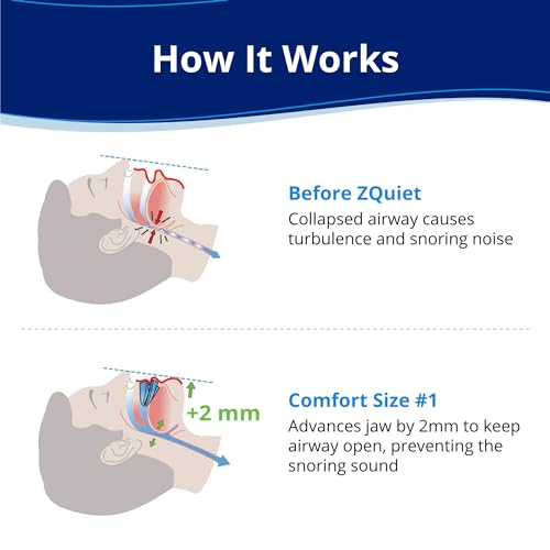 ZQuiet, Anti-Snoring Mouthpiece, Comfort Size #1, Single Refill, Blue, Made in USA, BPA-Free, Medical-Grade Material