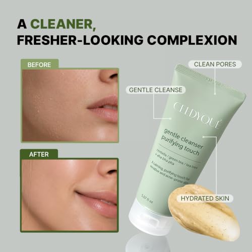 Image of Korean AHA BHA PHA Exfoliant Cleansing Foam Face Wash w / Centella, Tea Tree & Green Tea, Gentle Low pH Pore Minimizer Cleaner Cleanser for Sensitive & Acne-Prone Skin, Non-Stripping & Fragrance 5 Oz