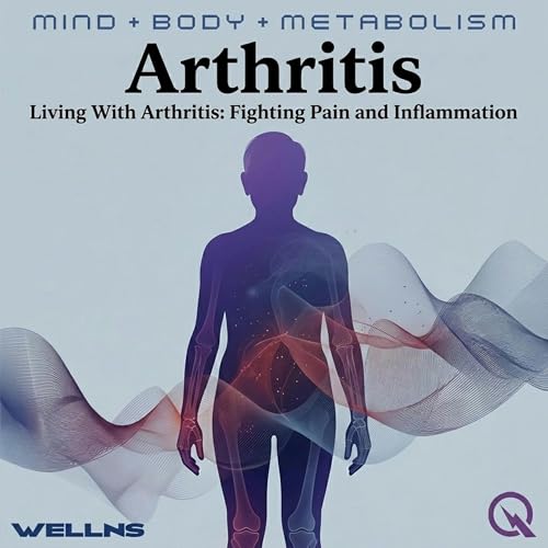 『Arthritis - Move It or Lose It: Exercise, Lifestyle, and the Art of Joint Preservation』のカバーアート