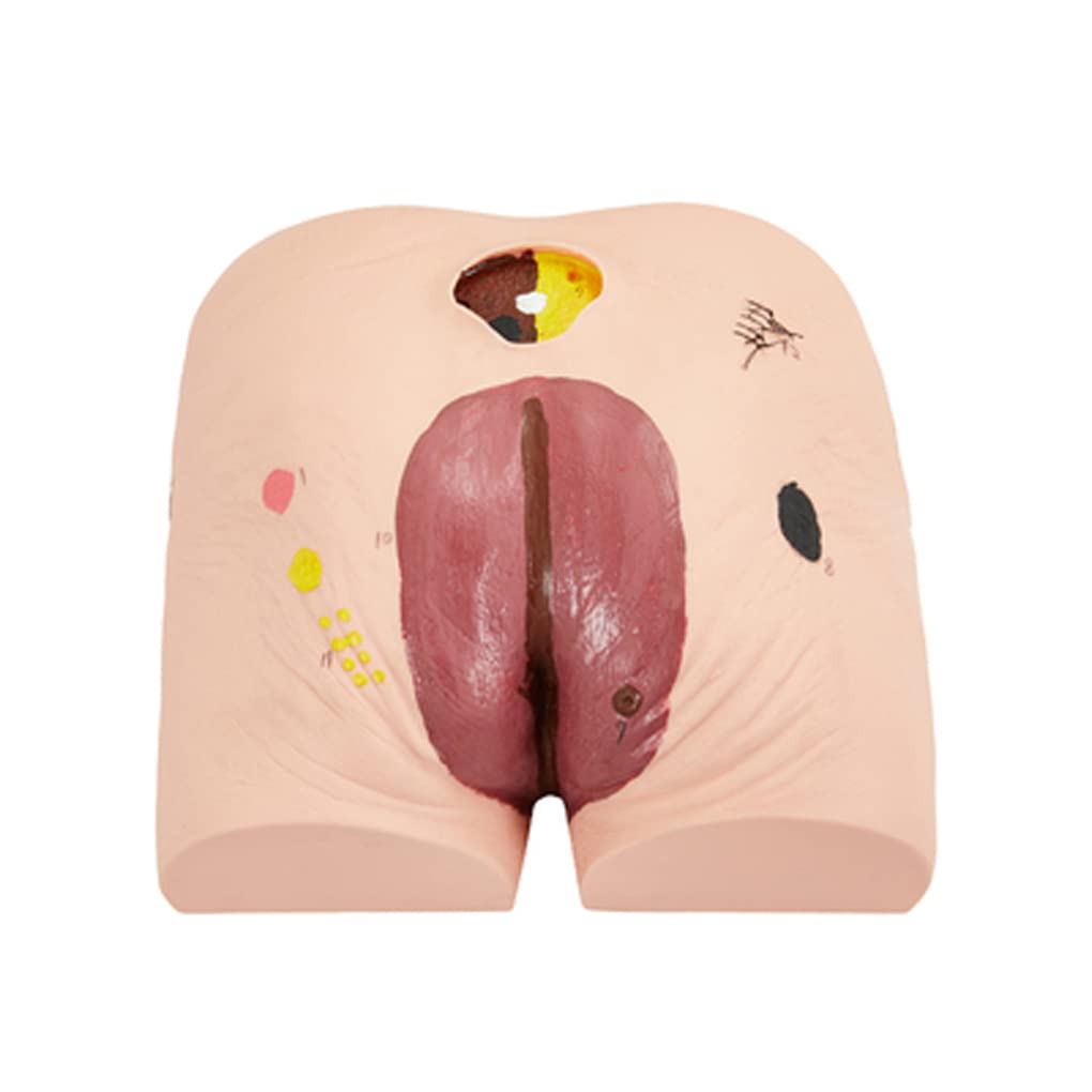 Outils de modèle d'enseignement, modèle de Soins des escarres de décubitus, modèle de Soins des escarres pour Personnes âgées, modèle d'enseignement du Mannequin, simulateur Humain