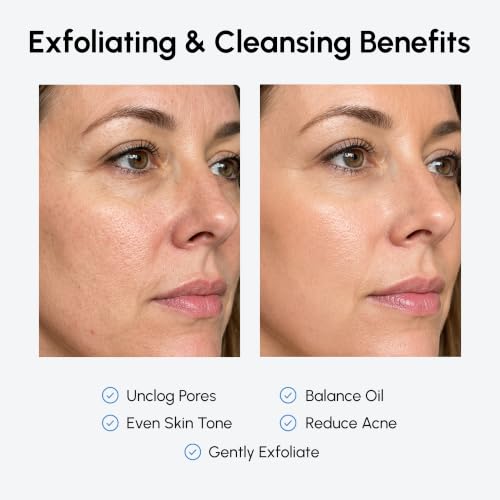 Image of MAREE Glycolic Acid Pads & 2% Salicylic Acid - Toner Pads for Face with 20% Glycolic Acid Solution - Face Exfoliating Pads, Acne Clearing Face Pads - Skin Pore Resurfacing & Radiance Device - 50 Count