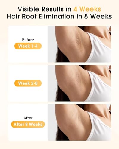 LYSMOSKI IPL Laser Hair Removal At Home Hair Removal for Women and Men Laser Hair Removal Device Pain-Free System for Lasting Hair Reduction on Face, Armpits, Bikini Area - Image 3