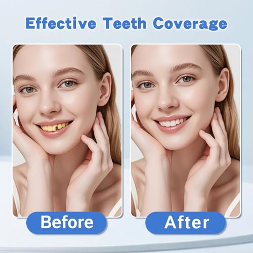 Image of 1 Pair Fake Dentures Teeth Covers for Men and Women Instant Dental Fix Easy to Use Snap-On Teeth Caps for Missing or Broken Temporary Smile Cover for Confidence and Comfort