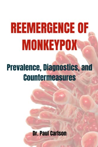 REEMERGENCE OF MONKEYPOX: Prevalence, Diagnostics, and Countermeasures