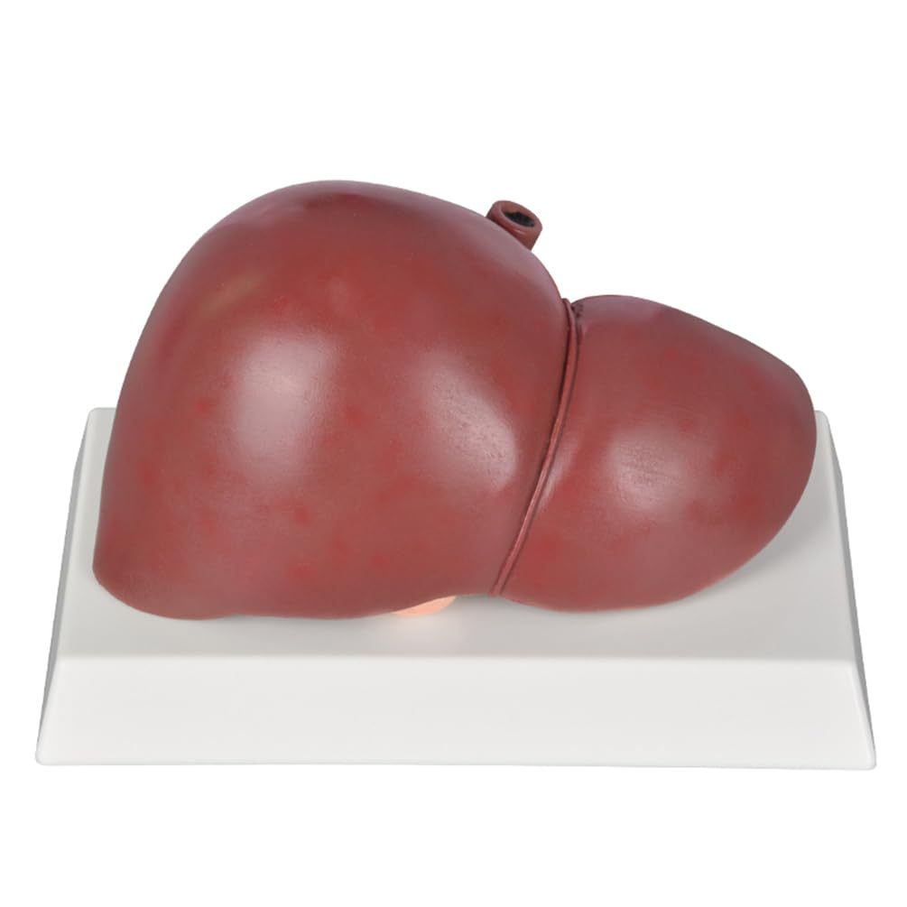 YRQMGSF Adult Normal Liver Model - Pathological Whole Liver Model - Silicone Human Internal Organs for Medical Research and Teaching