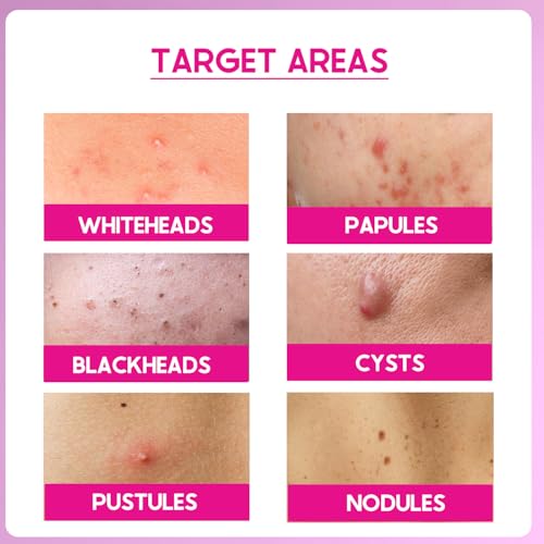 Image of Cos-IQ ABP11% (6% AHA + 1% BHA + 4% PHA) Peeling Solution Serum for Glowing Skin, Smooth Texture & Pore Cleansing | 11% AHA BHA PHA Peel For Beginners Friendly Exfoliation | 30ml