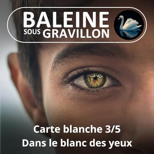 S05Exx Carte blanche 3/5 : Dans le blanc des yeux, c'est scl&egrave;re et net