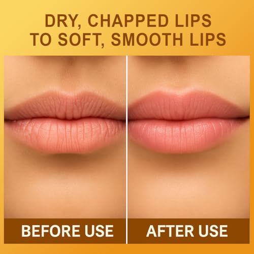 Image of HEY TEEN Honey Bee Lip Balm Pack of 2 | Red Honey, Shea Butter & Seabuckthorn Oil | Natural Moisturizing & Repairing | Glossy Finish | Kids & Teen Lip Care (5+ Years) | 8 ml Each