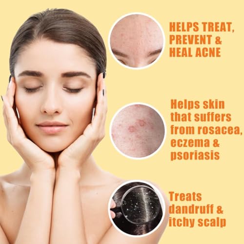 Natrulo 10% Sulfur Soap Cleansing Bar for Face & Body – All Natural Facial Cleanser for Acne, Oily Skin – Healing Skincare Blend of Lemongrass, Tea Tree Essential Oil, Vitamin E, Coconut Milk – Made in USA