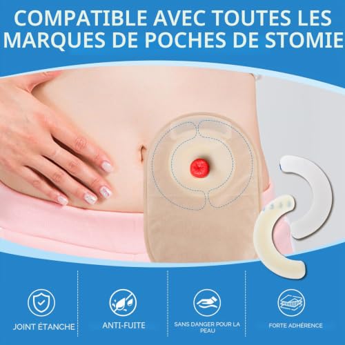 20pcs Bandes de barrière pour stomie élastiques, bandes de barrière cutanée hydrocolloïdes de qualité médicale, ruban adhésif imperméable et doux pour la peau pour sacs de stomie de colostomie – vue 8