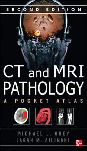CT & MRI Pathology: A Pocket Atlas, Second Edition CT & MRI Pathology: A Pocket Atlas, Second Edition