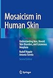 Mosaicism in Human Skin: Understanding Nevi, Nevoid Skin Disorders, and Cutaneous Neoplasia (English Edition)