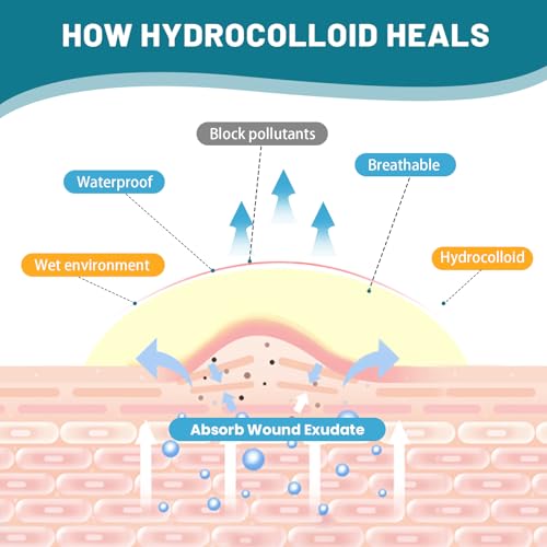 Image of Hydrocolloid Roll for Wound Care, 4in*6.6ft Hydrocolloid Bandages with Self-Adhesive, Extra Large Hydrocolloid Patch Bandages Cut-to-Size, Ultra Absorbent, Waterproof