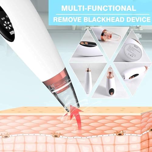 Image of 6 in 1 Multi-function Blackhead Remover Tools | Electric Derma suction Machine | USB Rechargeable Acne Pimple Pore Cleaner Vacuum tool | Facial Cleanser Device for Nose & Skin Care