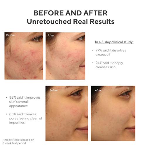 Murad Clarifying Cleanser - Acne Control Salicylic Acid & Green Tea Extract Face Wash - Exfoliating Acne Skin Care Treatment Backed by Science, 6.75 Oz