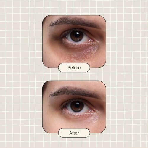 Lashfactor Under Eye Gel Serum (30g) - Hydrating Eye Serum for Dark Circles, Puffy Eyes, Eye Bags - Eye Bags Remover - Anti Ageing Eye Serum - 96% Users Reported a Reduction of Dark Circles - Image 7