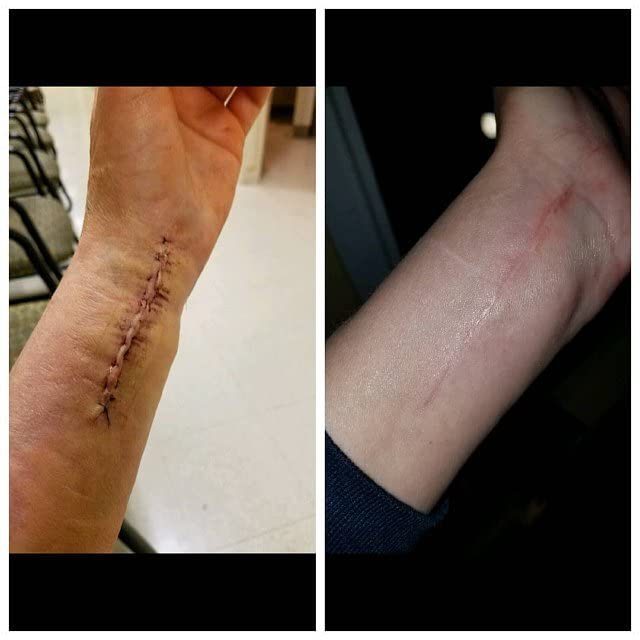 Miniatura 4 de Tamanu Multi Purpose  Cracked Skin  First Aid Ointment  Wounds  Scars Surgery Stitches Infection  Hemorrhoids Boils  Abscess  Fissures + Hemorrhoids