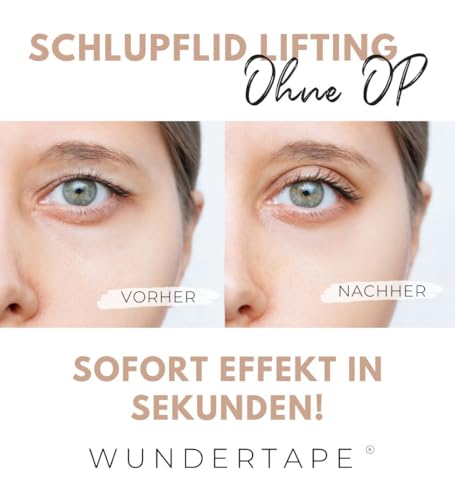 WUNDERTAPE Schlupflider Stripes LARGE & STRONG Schlupflid-Tape Streifen zum Augenlid-Lifting ohne OP! (wasserfest, 24h Halt, double eyelid lifting tapes) Augenlid-Tape (140 L)