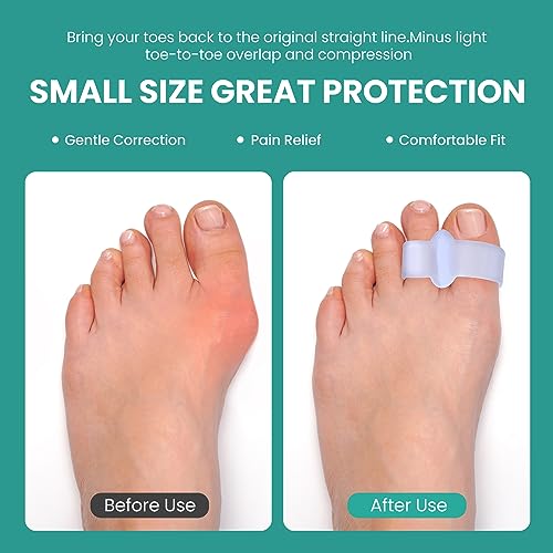 Welnove Pack of 12 Bunion Corrector, Toe Separators with 2 Loops, Big Toe Spacer Suitable for Bunion and Overlapping Toe (Violet)