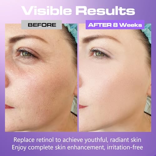 Viktairy Bakuchiol Serum Concentrate, High-Potency Mix-In Bakuchiol Oil Serum, Gentle Retinol Alternative for Wrinkle Reduction, Hydrating & Firming Anti-Aging Skincare, Vegan Non-GMO, 30ml 10,000ppm