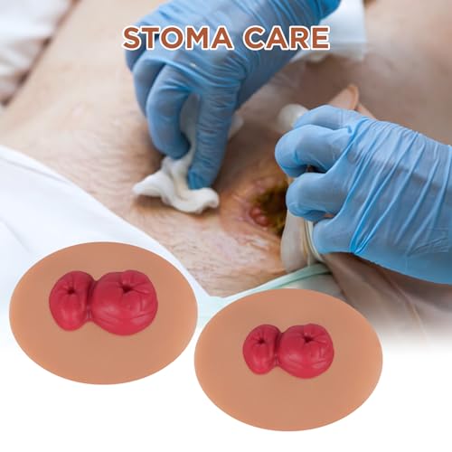 Image of Sticky Loop Ileostomy Simulators, Double-Barrel Stoma Training Model Set, Multi-Skin Tone Ostomy Care Practice Models for Medical Training and Patient Education - Tan