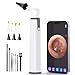 Industrial Endoscope, ScopeAround 1080P Dual Lens Inspection Camera, 16.5ft Waterproof Borescope 4.5" Screen Snake Camera with 6 LED Lights,Semi-Rigid Cable, 32GB TF Card (PU Bag)