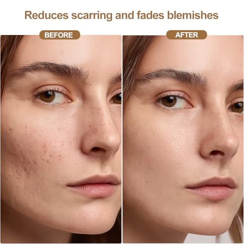 Red Light Therapy Mask for Face, Wireless Led Face Mask Light Therapy with 850nm Near-Infrared, 4 Modes Rechargeable Led Facial Skincare Device